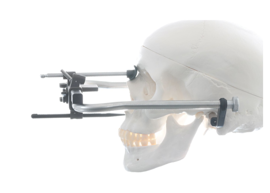 なぜ精密な歯科治療には「フェイスボウトランスファー」が必要なのか