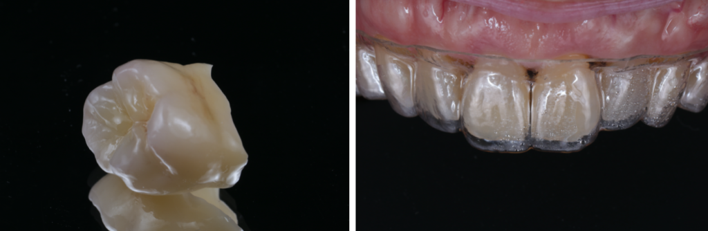 全体的な補綴歯科治療を考えている方へ