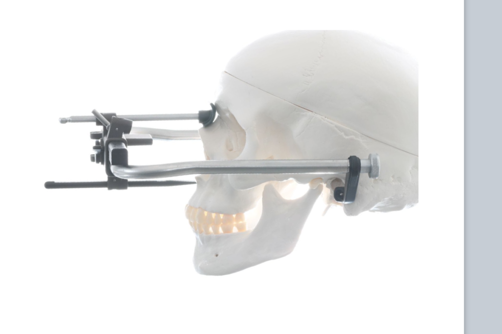 フェイスボウトランスファー