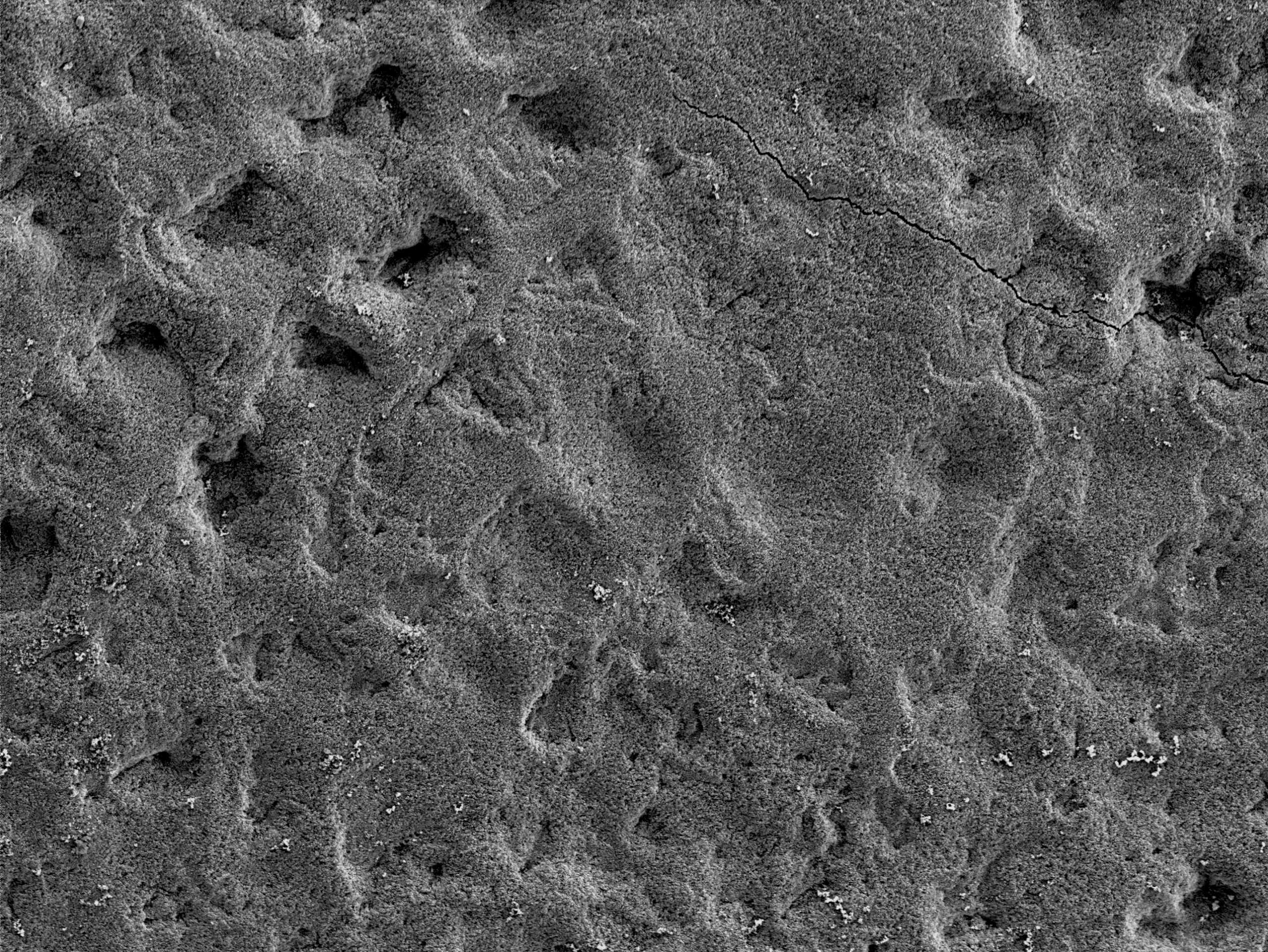 審美修復物の保全