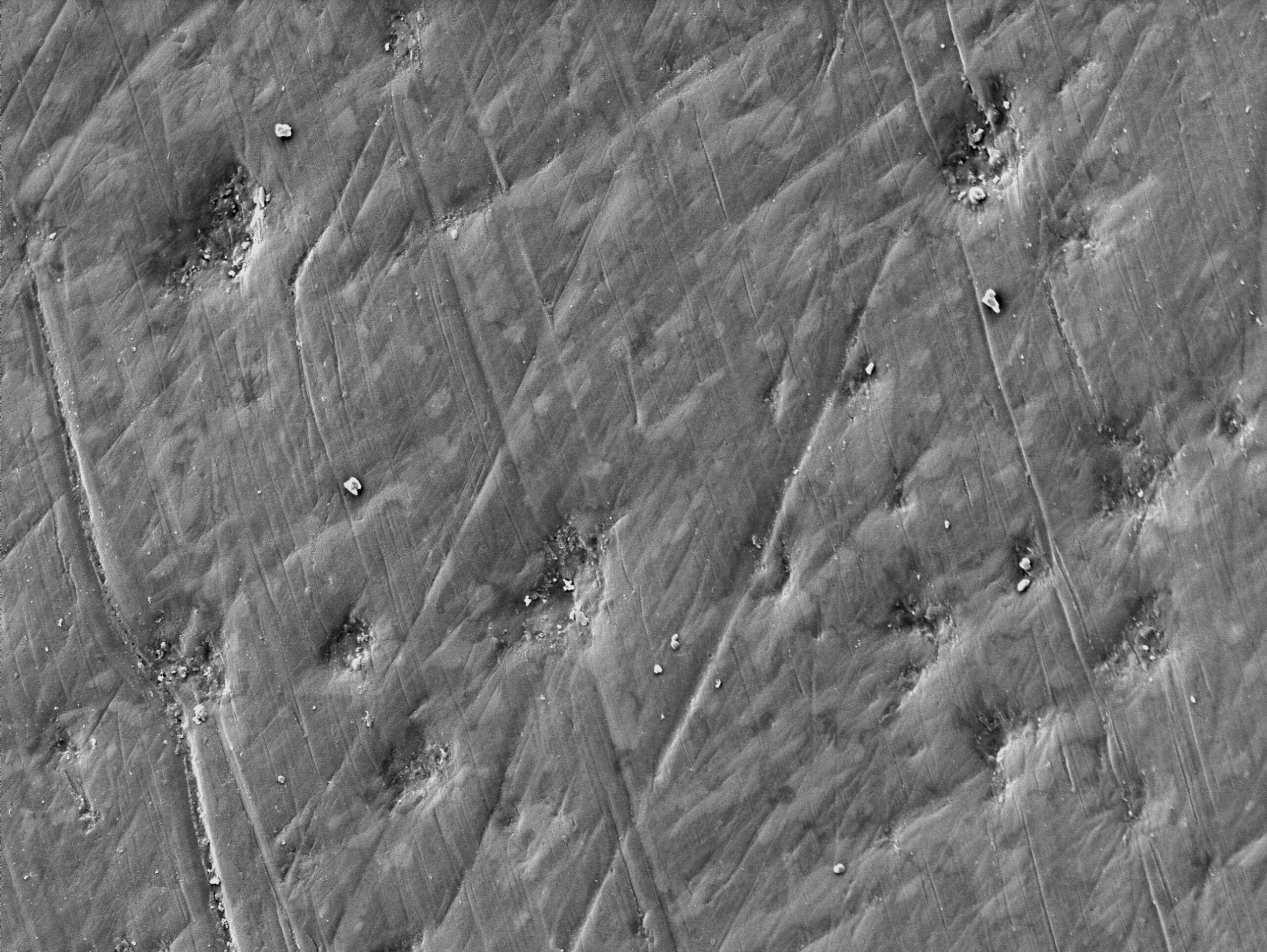 審美修復物の保全