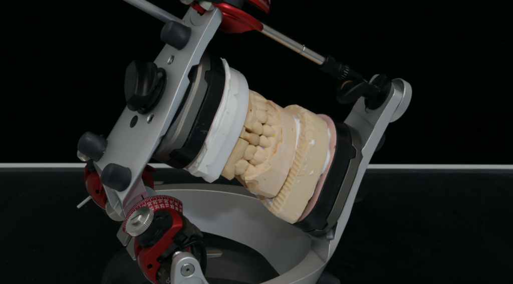 咬合器とフェイスボウとは何か?