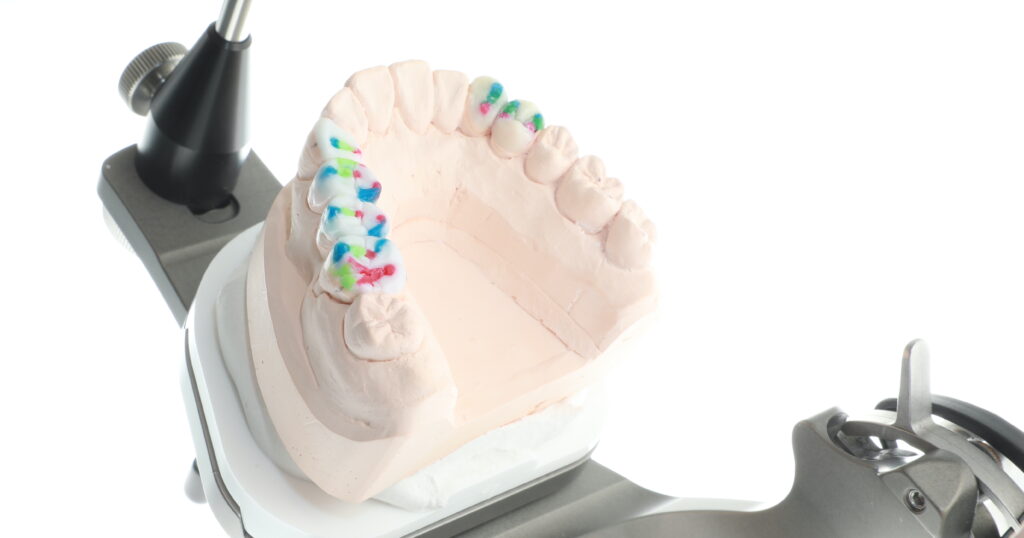 一生モノの噛み合わせ「シークエンシャル咬合」とは?あなたの歯を守る最後の切り札