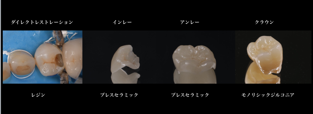 「セラミックを松竹梅で選ばせる歯医者に違和感はありませんか？」