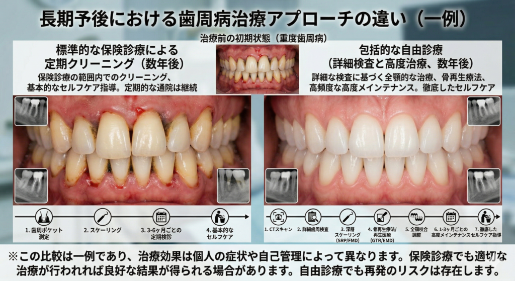 歯周病は“歯ぐきの病気”ではなく、“歯を支える骨の病気”です